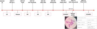 The safety and efficacy of the re-administration of gilteritinib in a patient with FLT3-mutated R/R AML with CNS relapse: a case report
